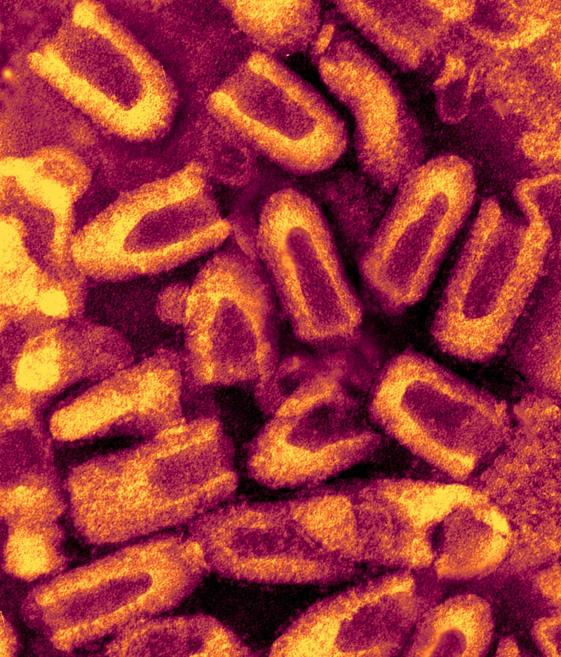 Illustration for article titled Psychedelic Images of Terrifying Viruses
